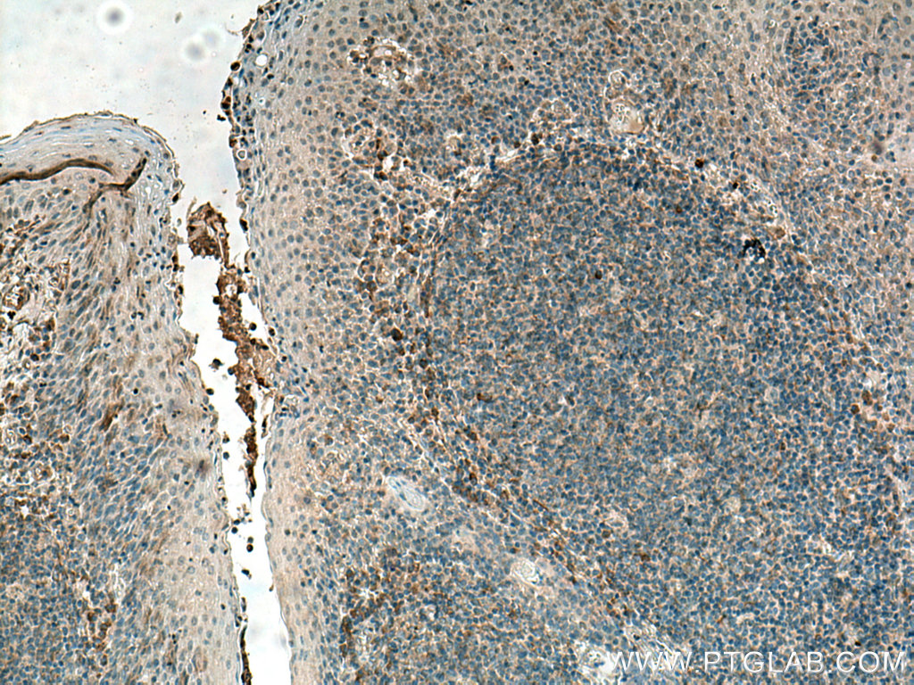 IL-37 Polyclonal antibody