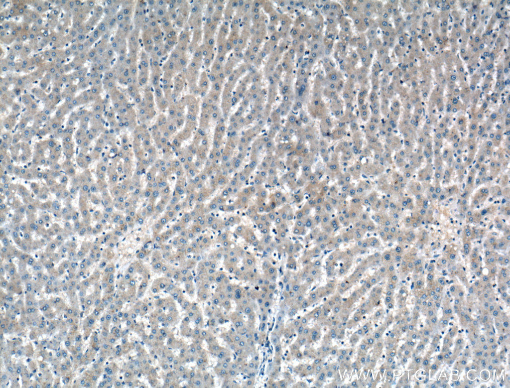 ADAMTS4 Polyclonal antibody