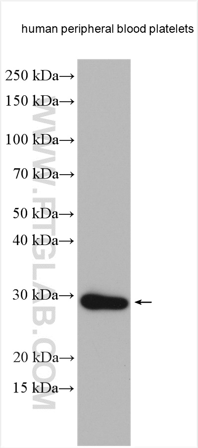 RGS18 Polyclonal antibody