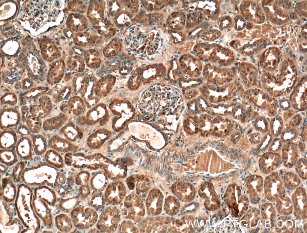 VPS37A Polyclonal antibody
