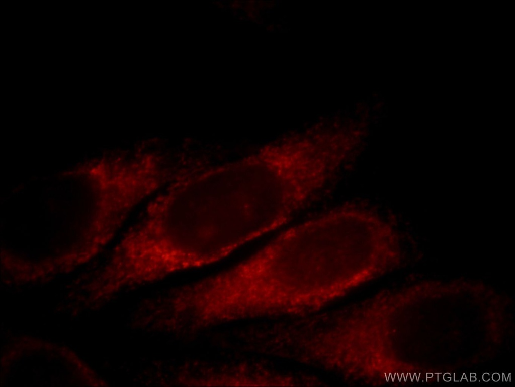 SLC4A4 Polyclonal antibody