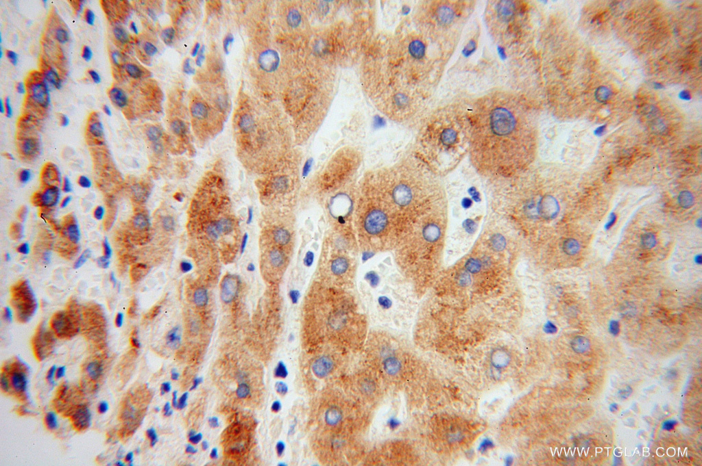 Prealbumin/transthyretin Polyclonal antibody
