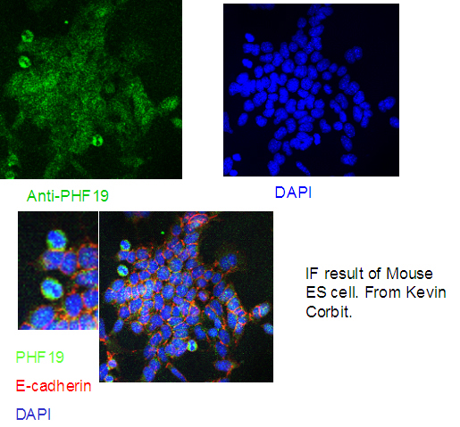 PHF19 Polyclonal antibody