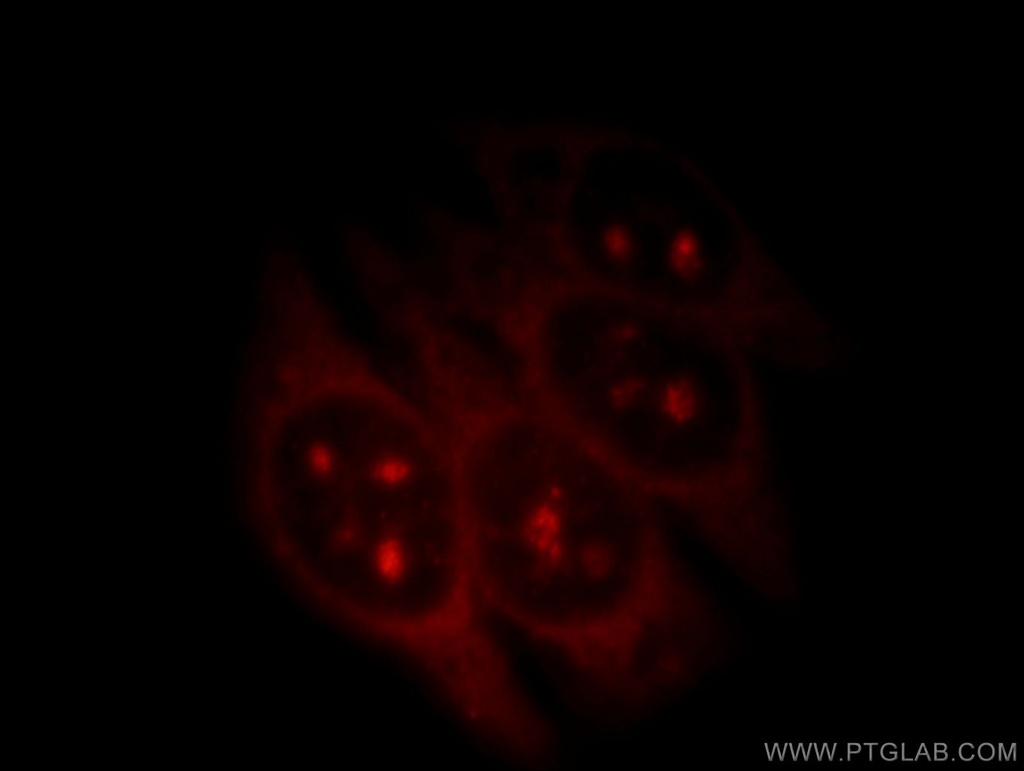 RNF7 Polyclonal antibody