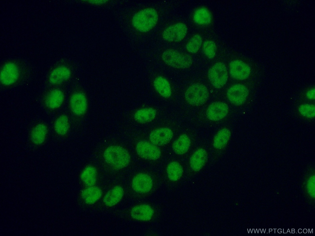 ATF2 Polyclonal antibody
