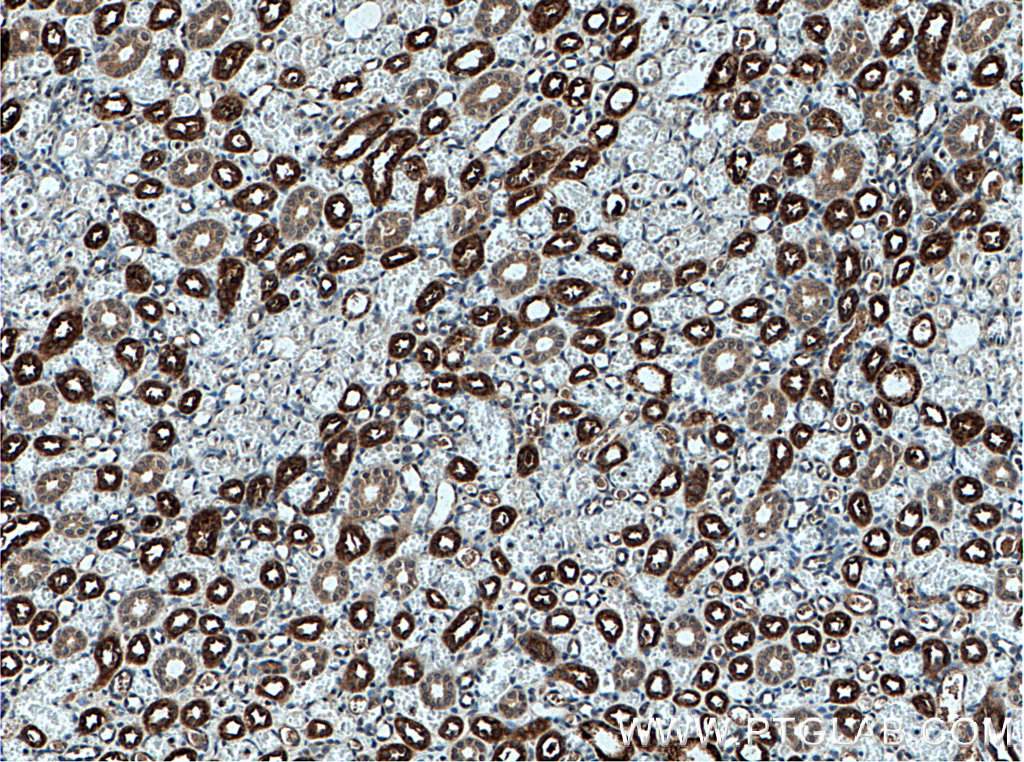 Uromodulin Polyclonal antibody