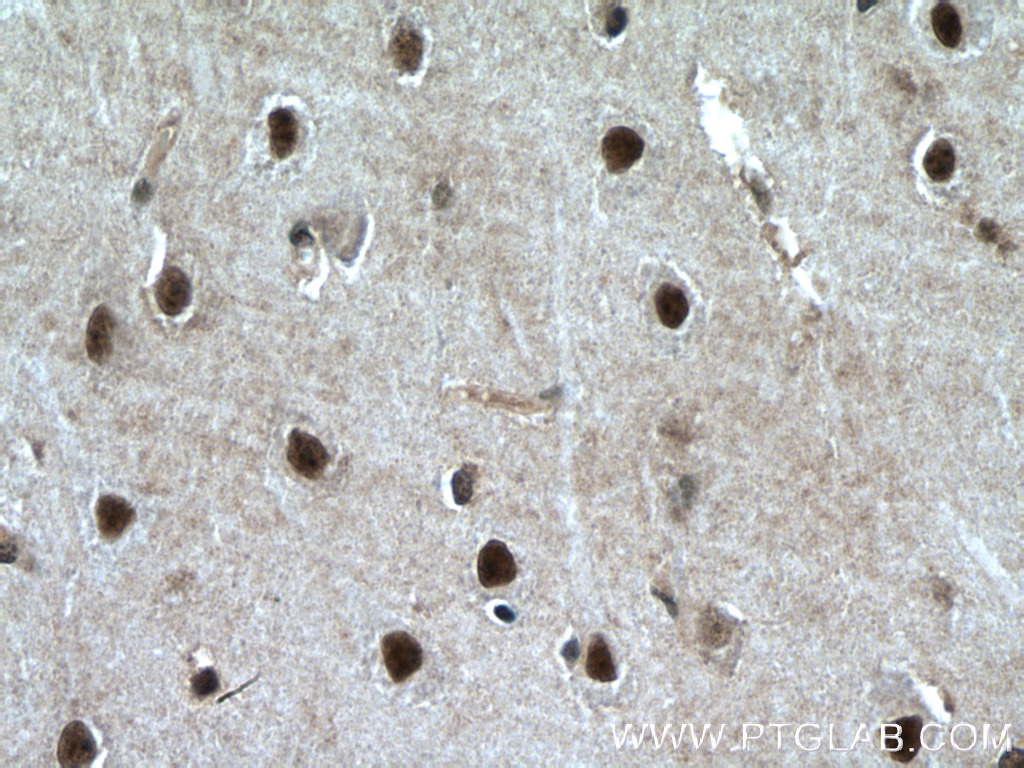 PLRG1 Polyclonal antibody