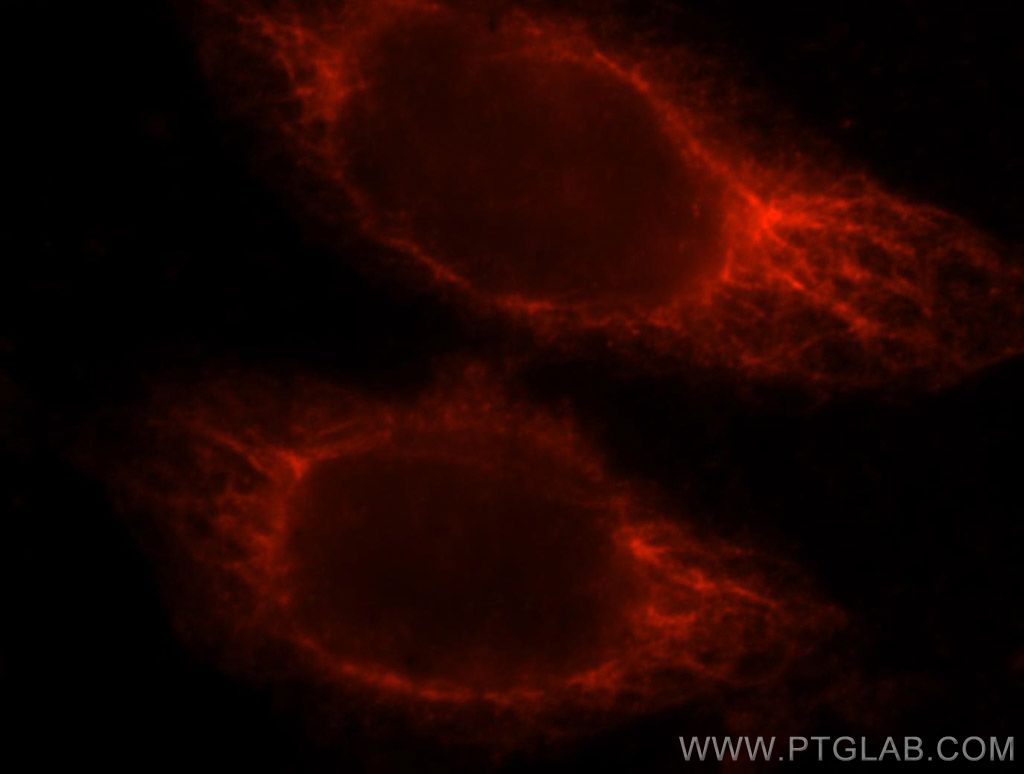 RASSF6 Polyclonal antibody