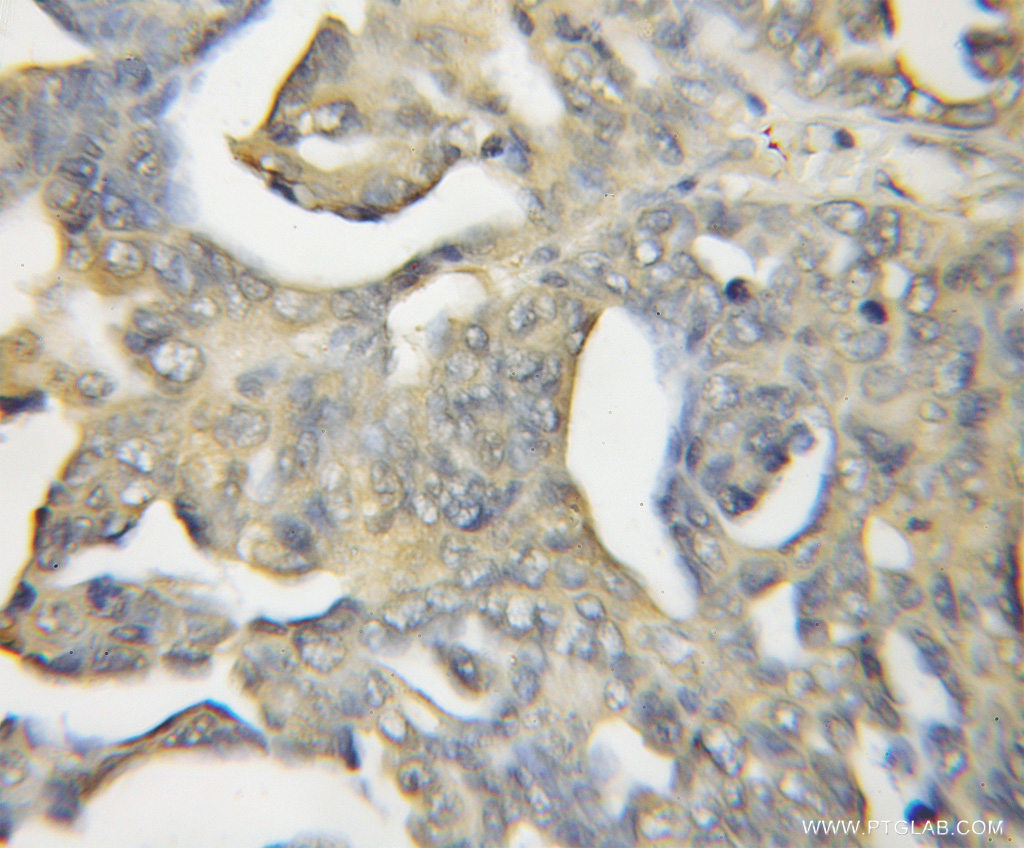 Calcyphosine 2 Polyclonal antibody
