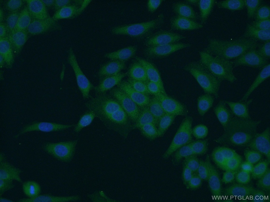 SCHIP1 Polyclonal antibody
