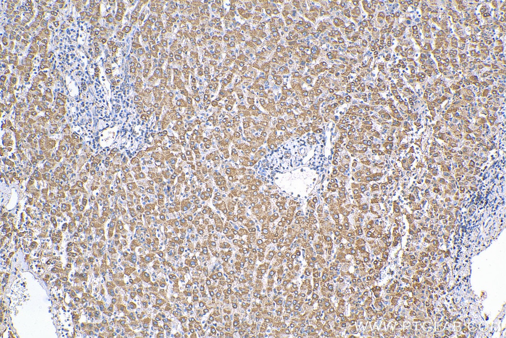 ST7 Polyclonal antibody