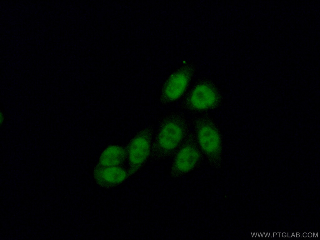 CBP20 Polyclonal antibody