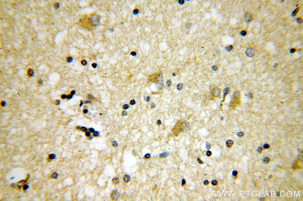 PSTPIP1 Polyclonal antibody