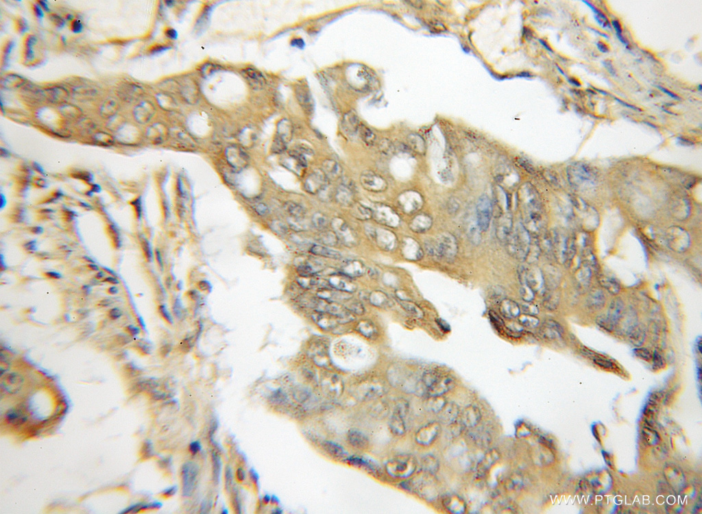 TRIM6 Polyclonal antibody