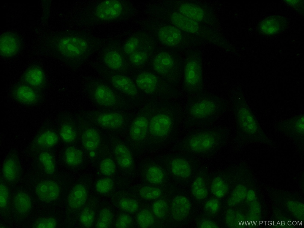 NPM3 Polyclonal antibody