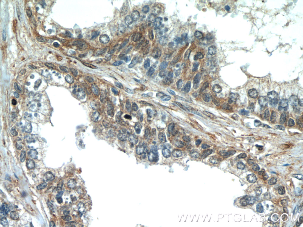 PAGE2 Polyclonal antibody
