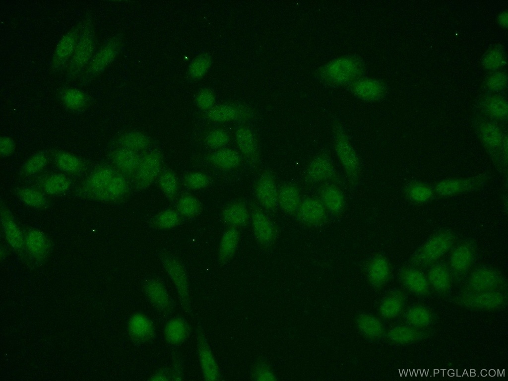 EMG1 Polyclonal antibody