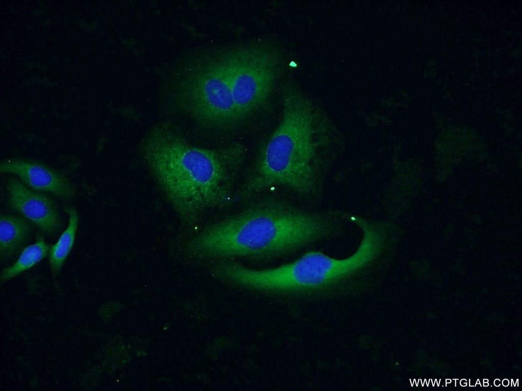 AGR3 Polyclonal antibody