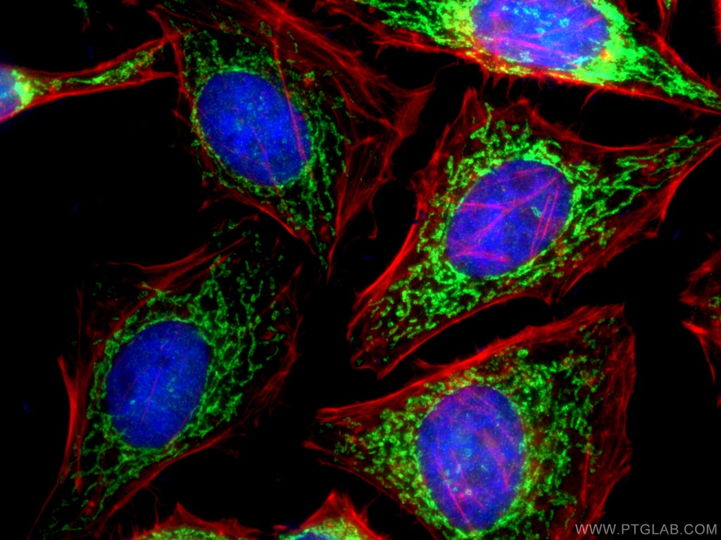 TIMM13 Polyclonal antibody