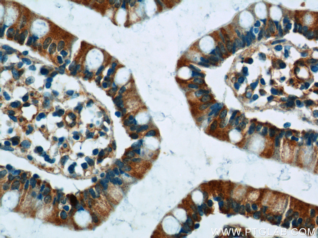 FICD Polyclonal antibody