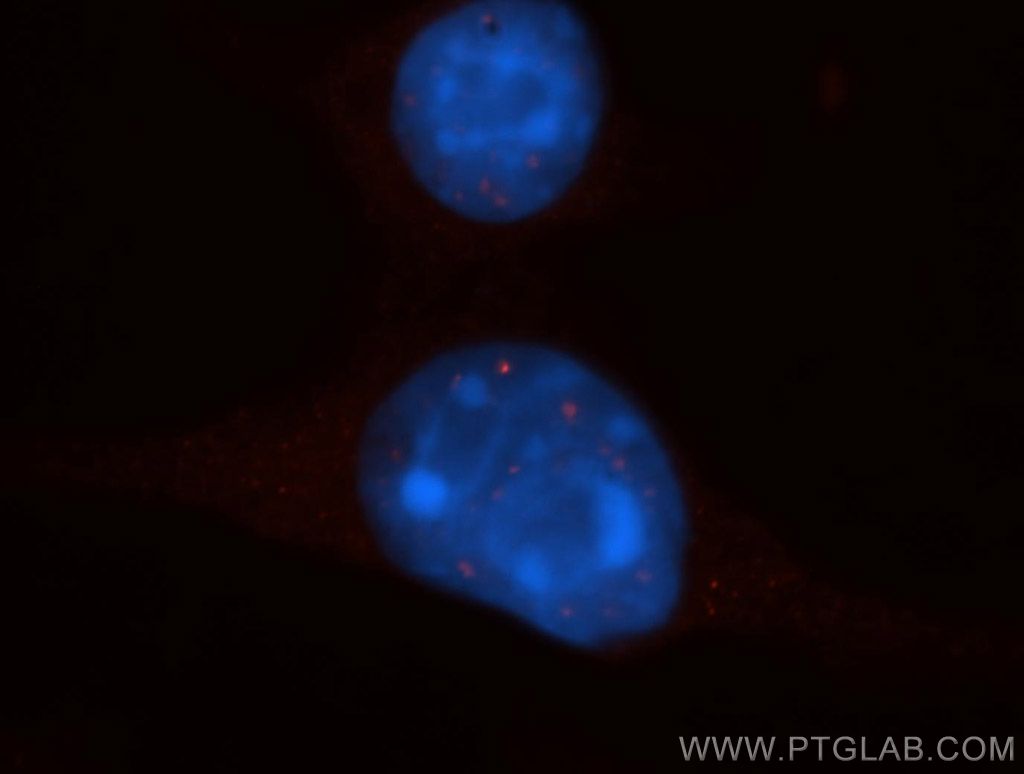 EXOSC8 Polyclonal antibody