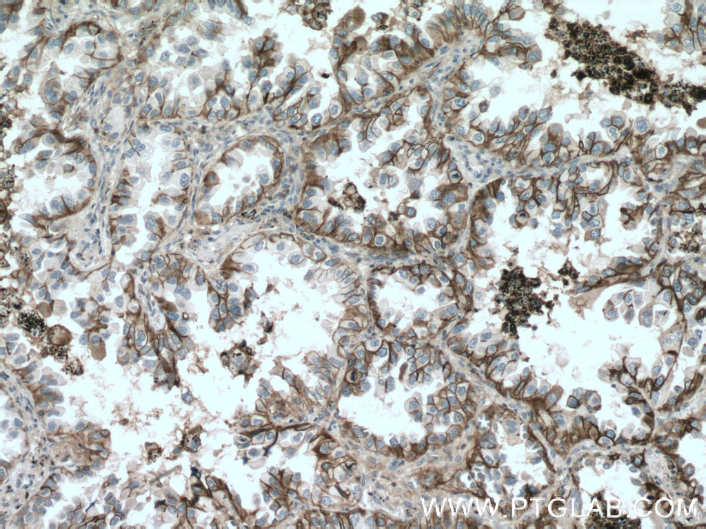 CD147 Polyclonal antibody