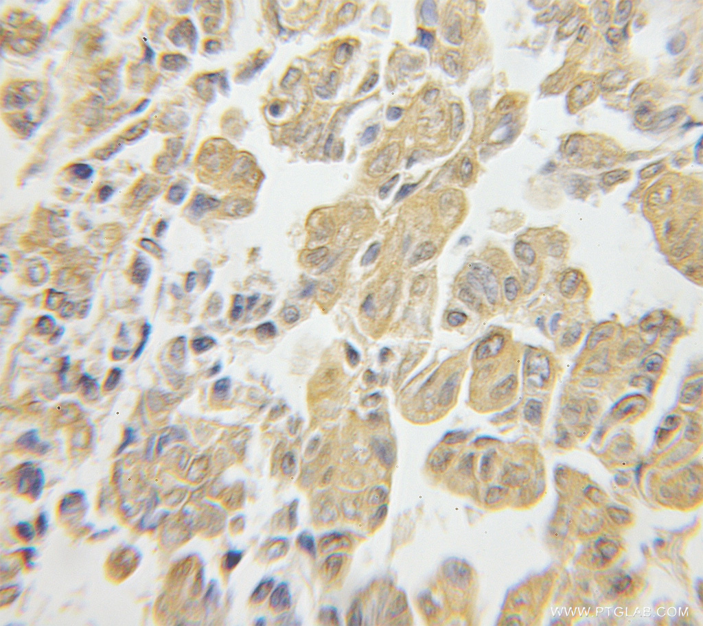 RPS3 Polyclonal antibody