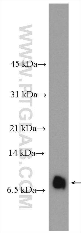 RANTES Polyclonal antibody