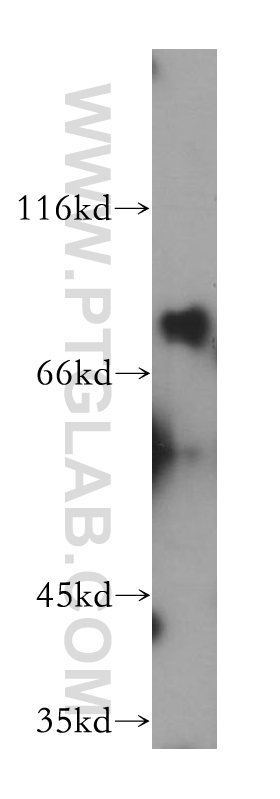Dymeclin Polyclonal antibody