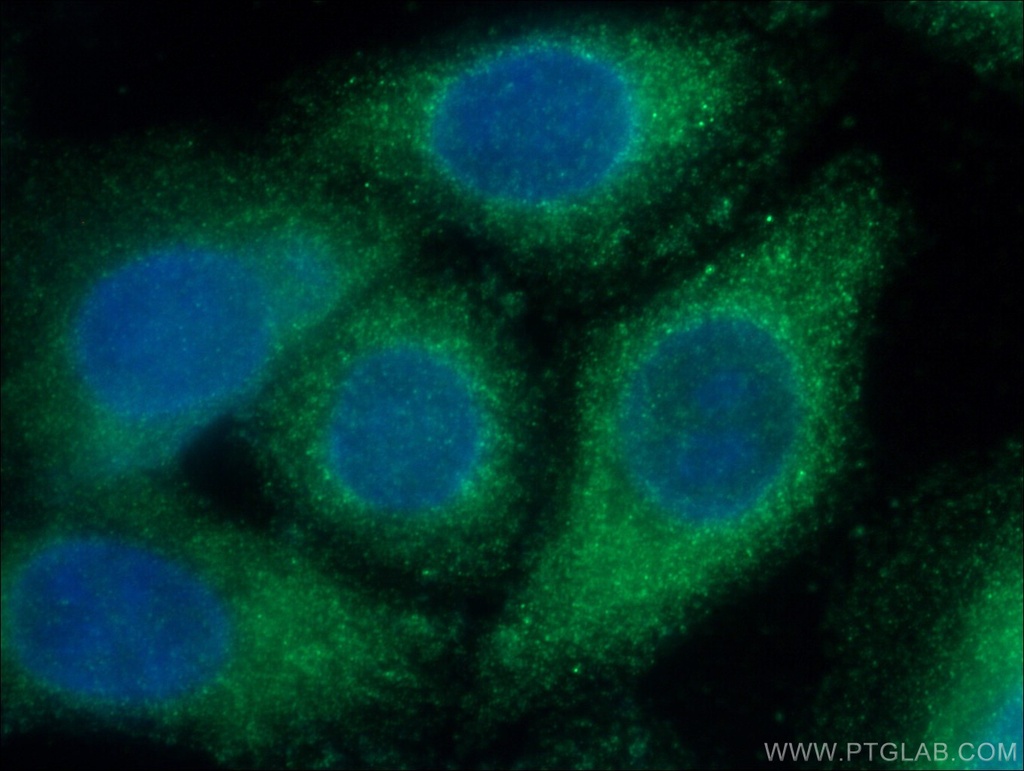SERPINA6 Polyclonal antibody