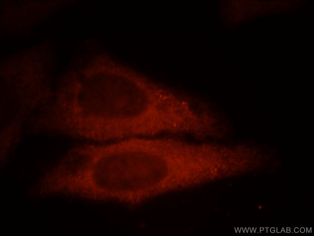 UBE2G1 Polyclonal antibody