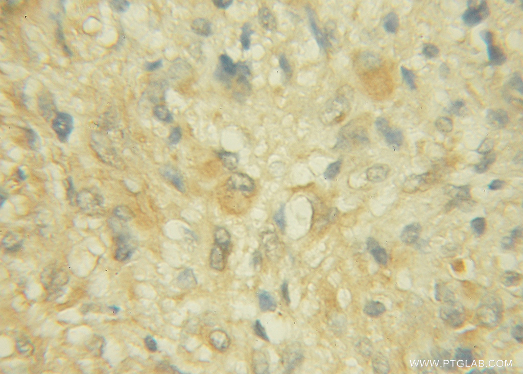 CHST10 Polyclonal antibody