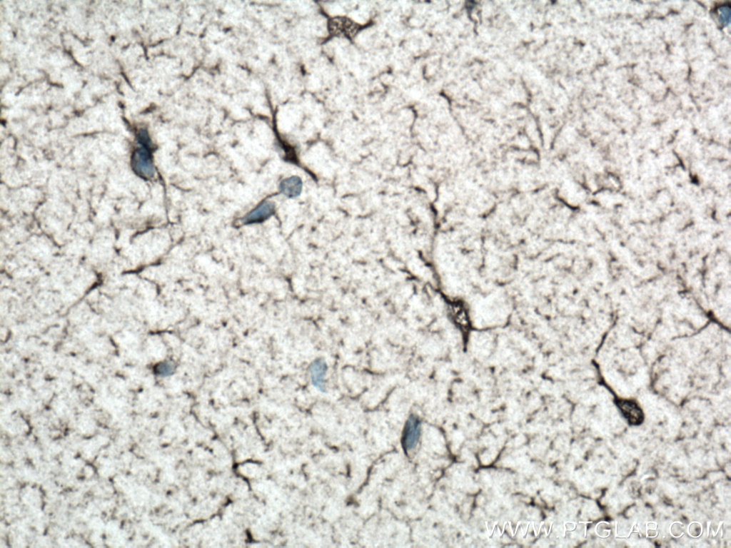 NDRG2 Polyclonal antibody