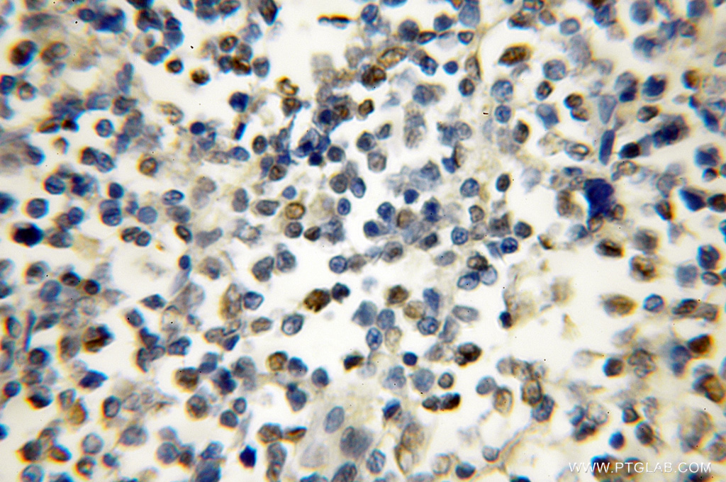 IKZF1 Polyclonal antibody