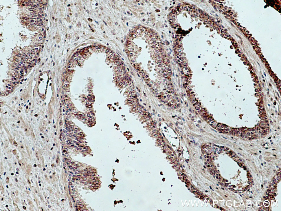 TBCE Polyclonal antibody