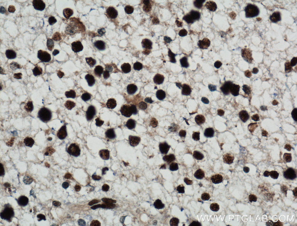 NUCKS1 Polyclonal antibody