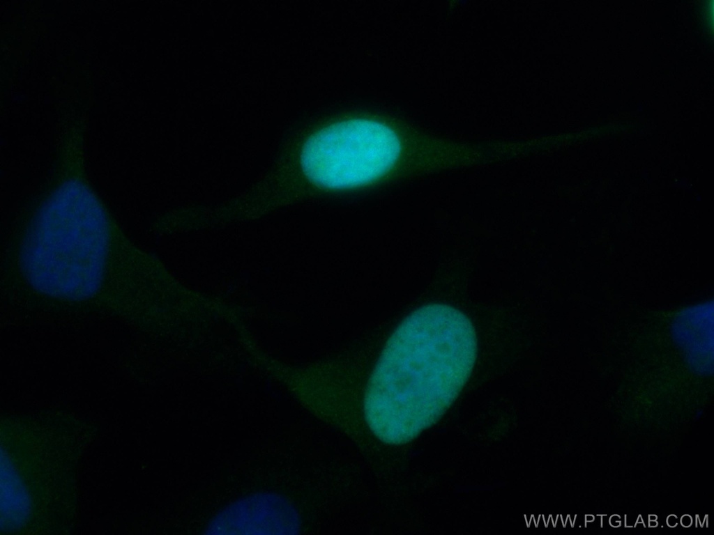 NUSAP1 Polyclonal antibody