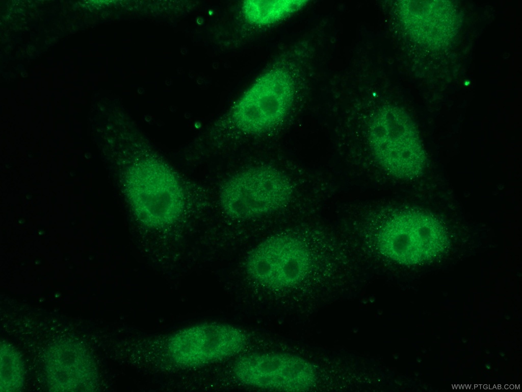 HOXC10 Polyclonal antibody