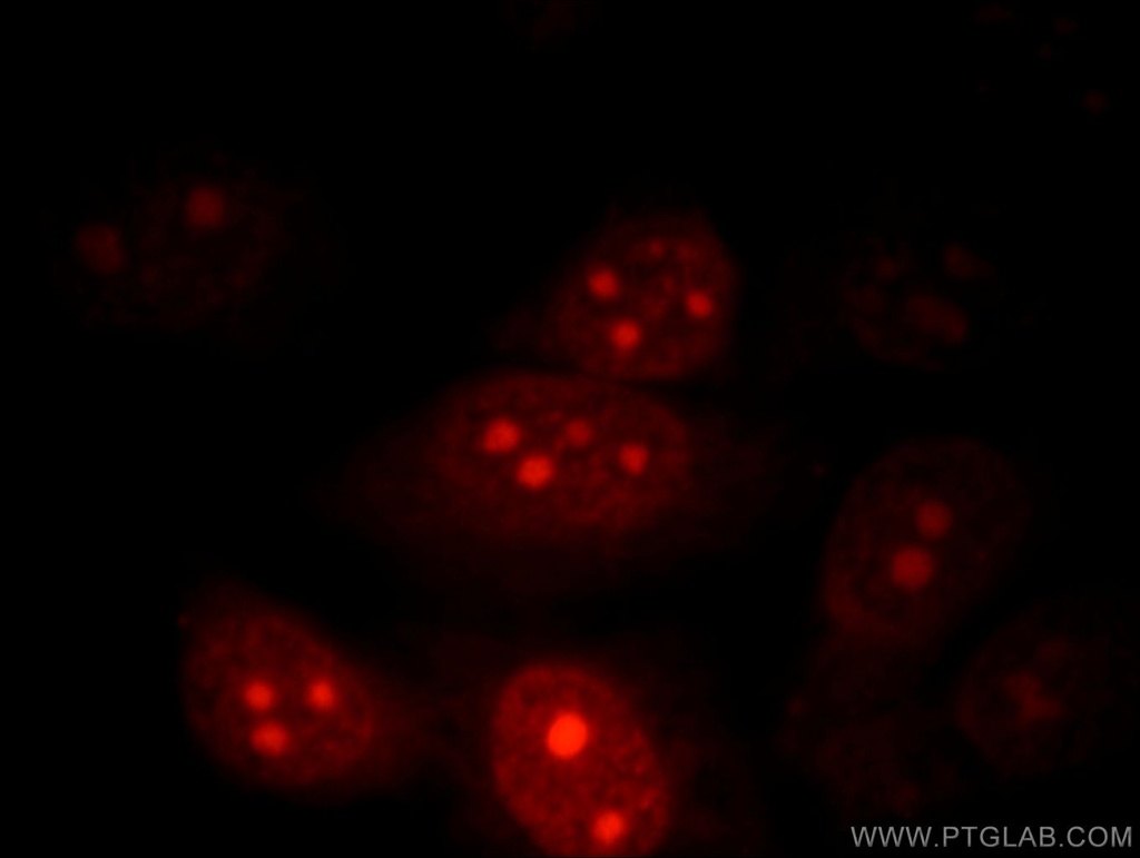 POP1 Polyclonal antibody