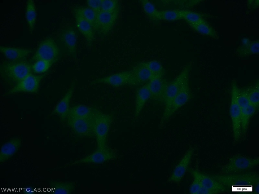 WBP2 Polyclonal antibody