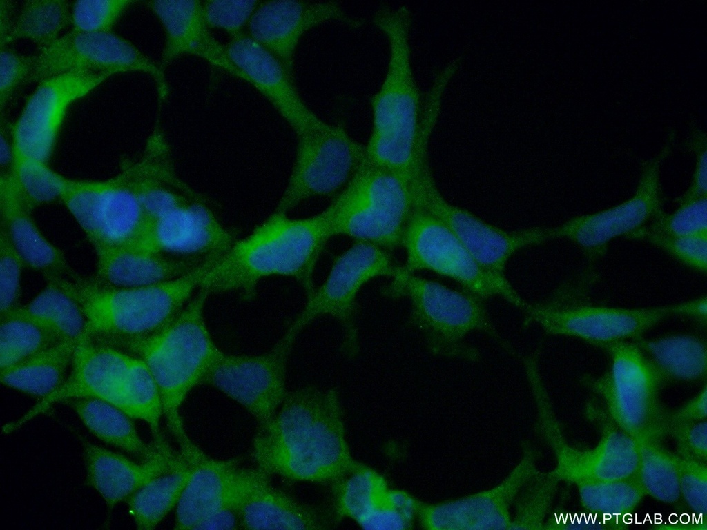 HURP Polyclonal antibody