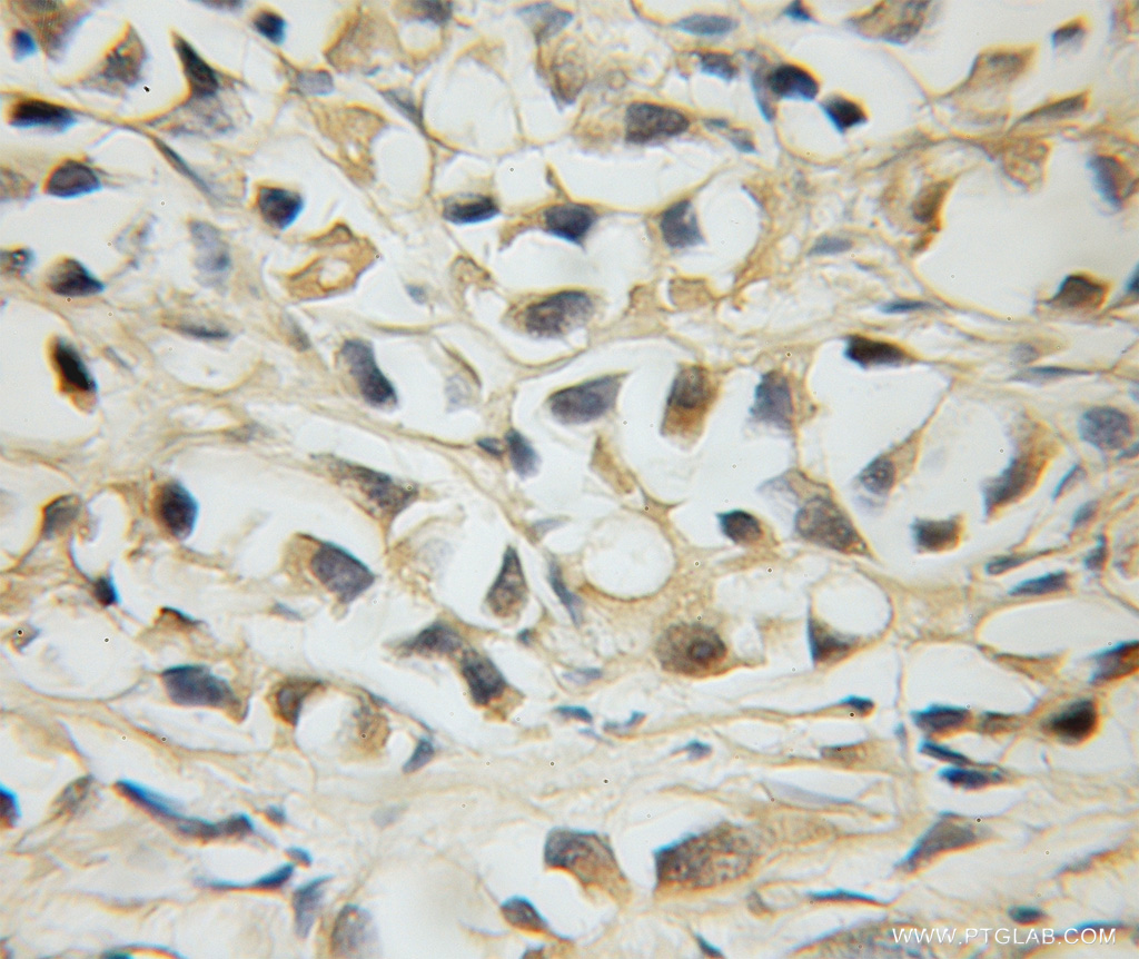 MLX Polyclonal antibody