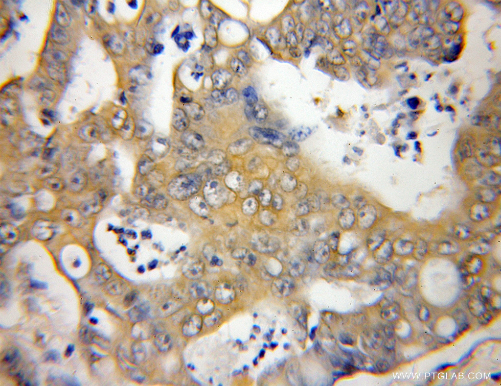 SLU7 Polyclonal antibody