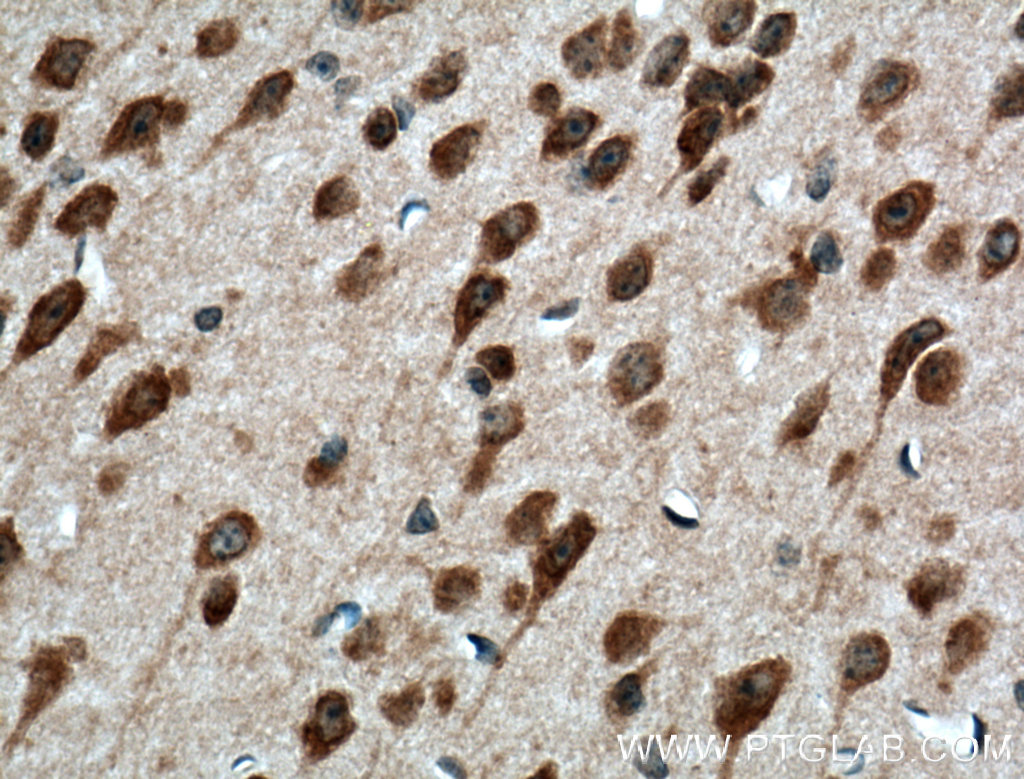 PELI1 Polyclonal antibody