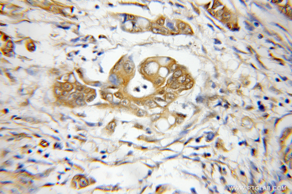 PSMD3 Polyclonal antibody