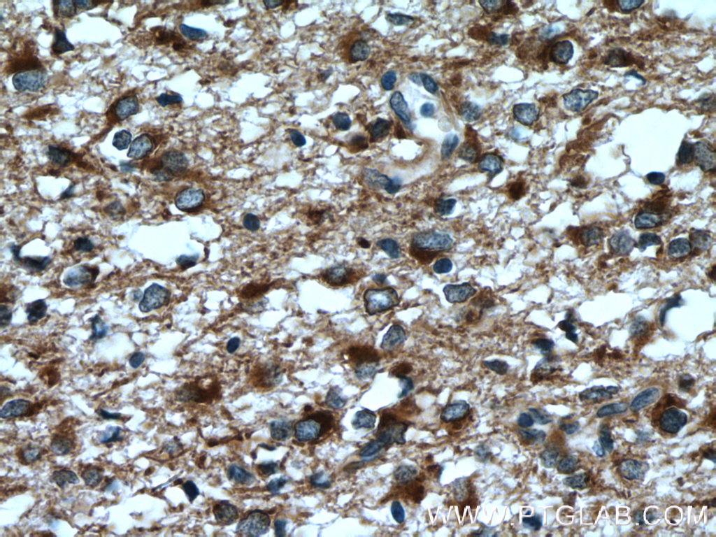 RTN3 Polyclonal antibody