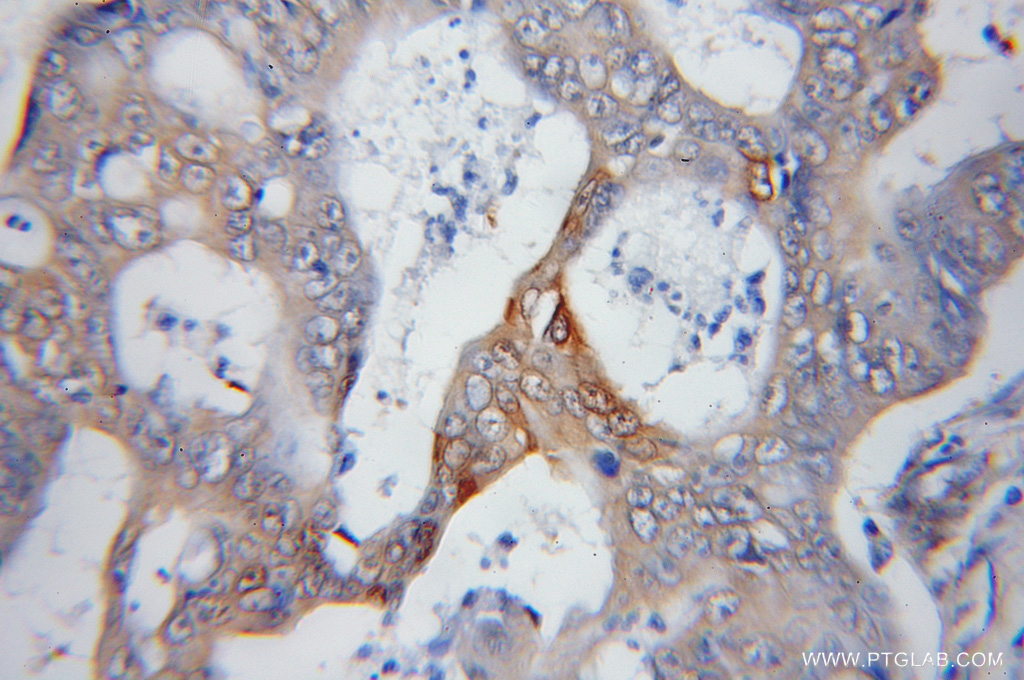 PSMD14/POH1 Polyclonal antibody