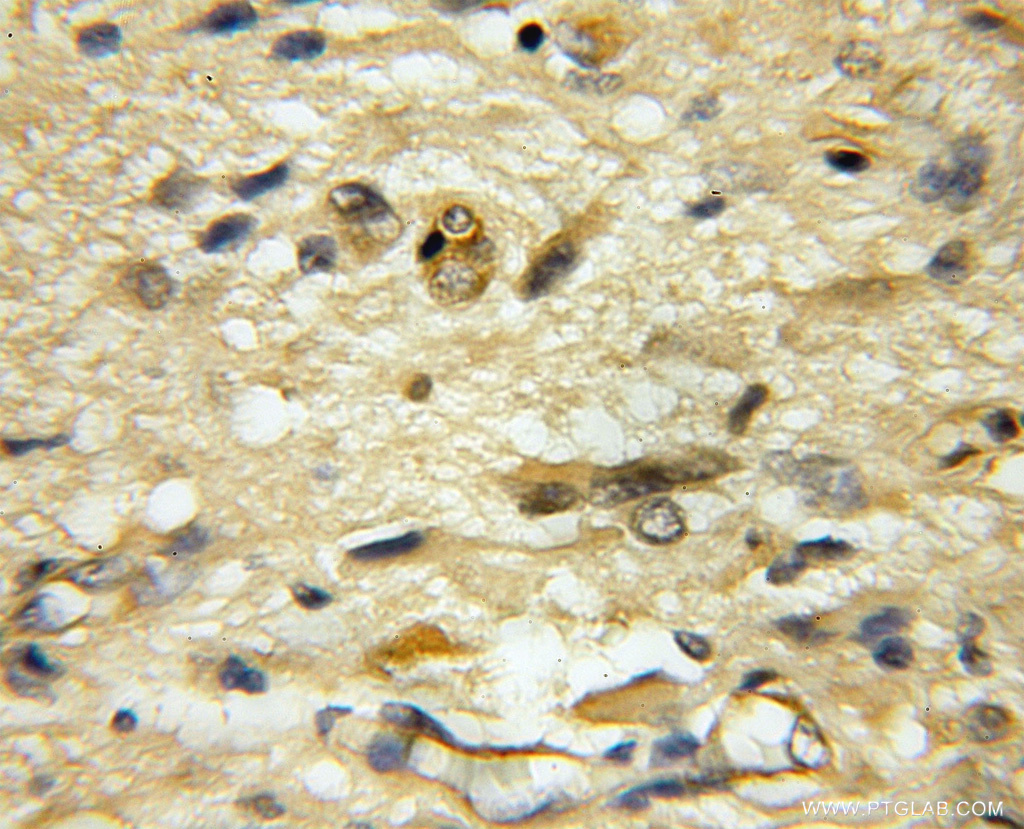 USP33 Polyclonal antibody