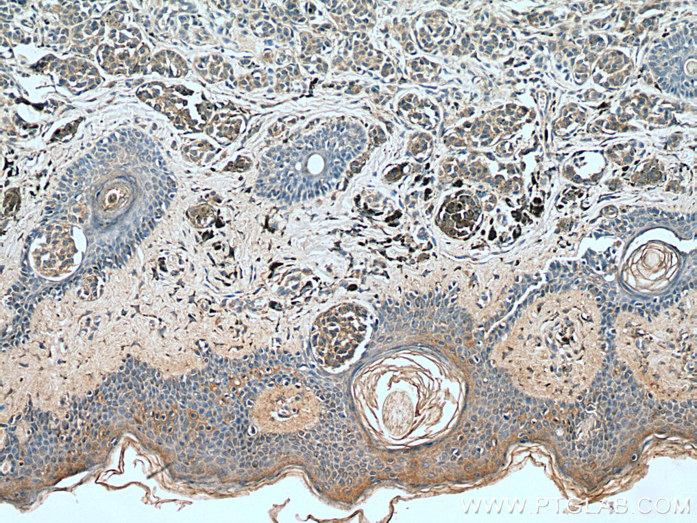 IL-24 Polyclonal antibody