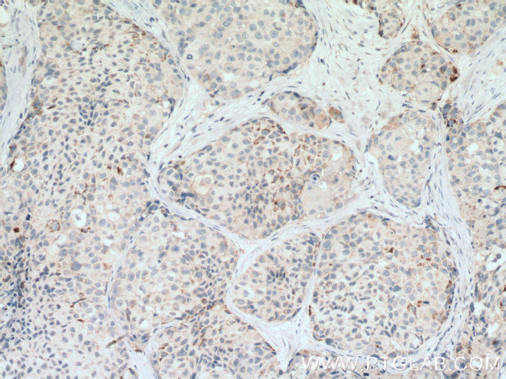 RARRES3 Polyclonal antibody
